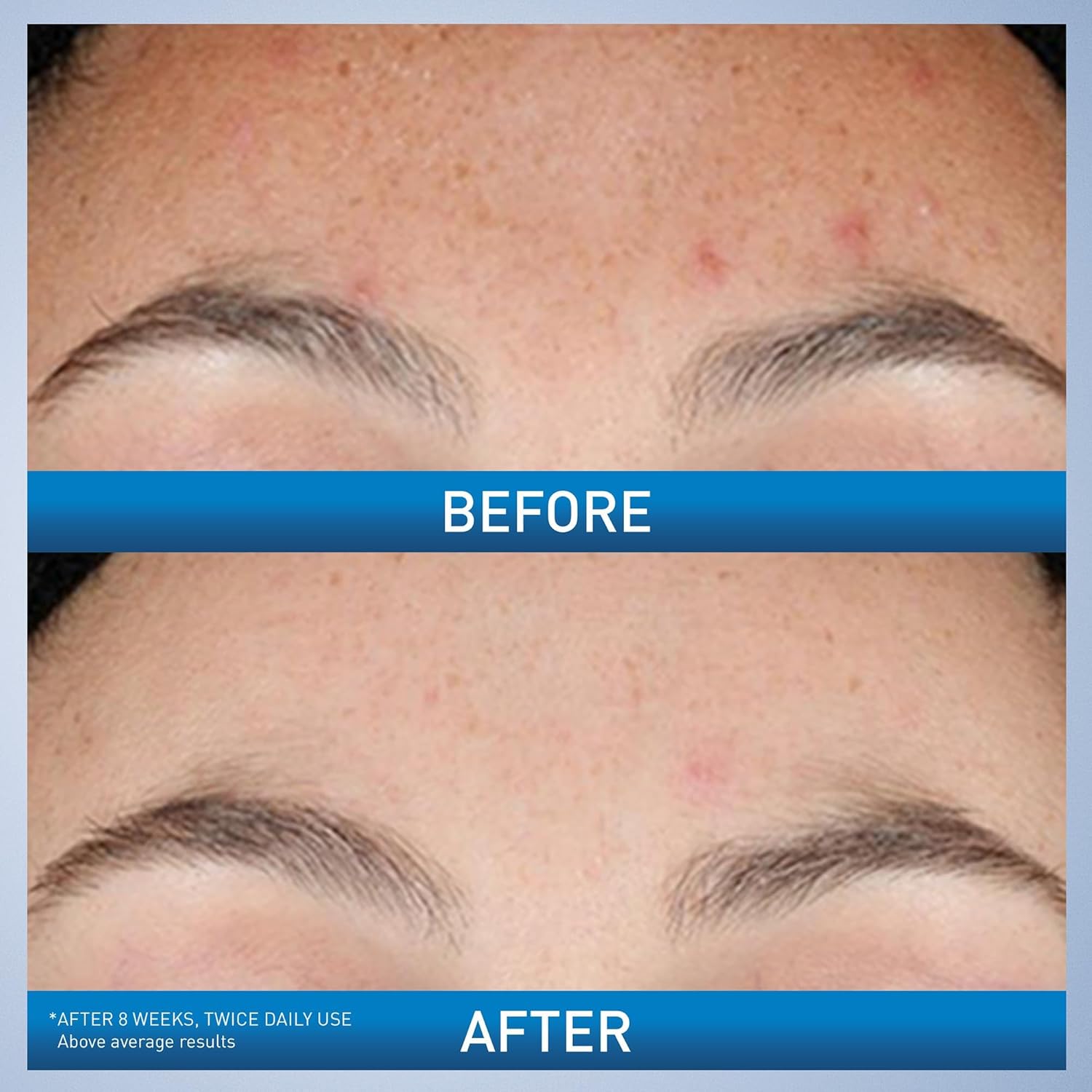 CeraVe Resurfacing Retinol Serum 1 oz