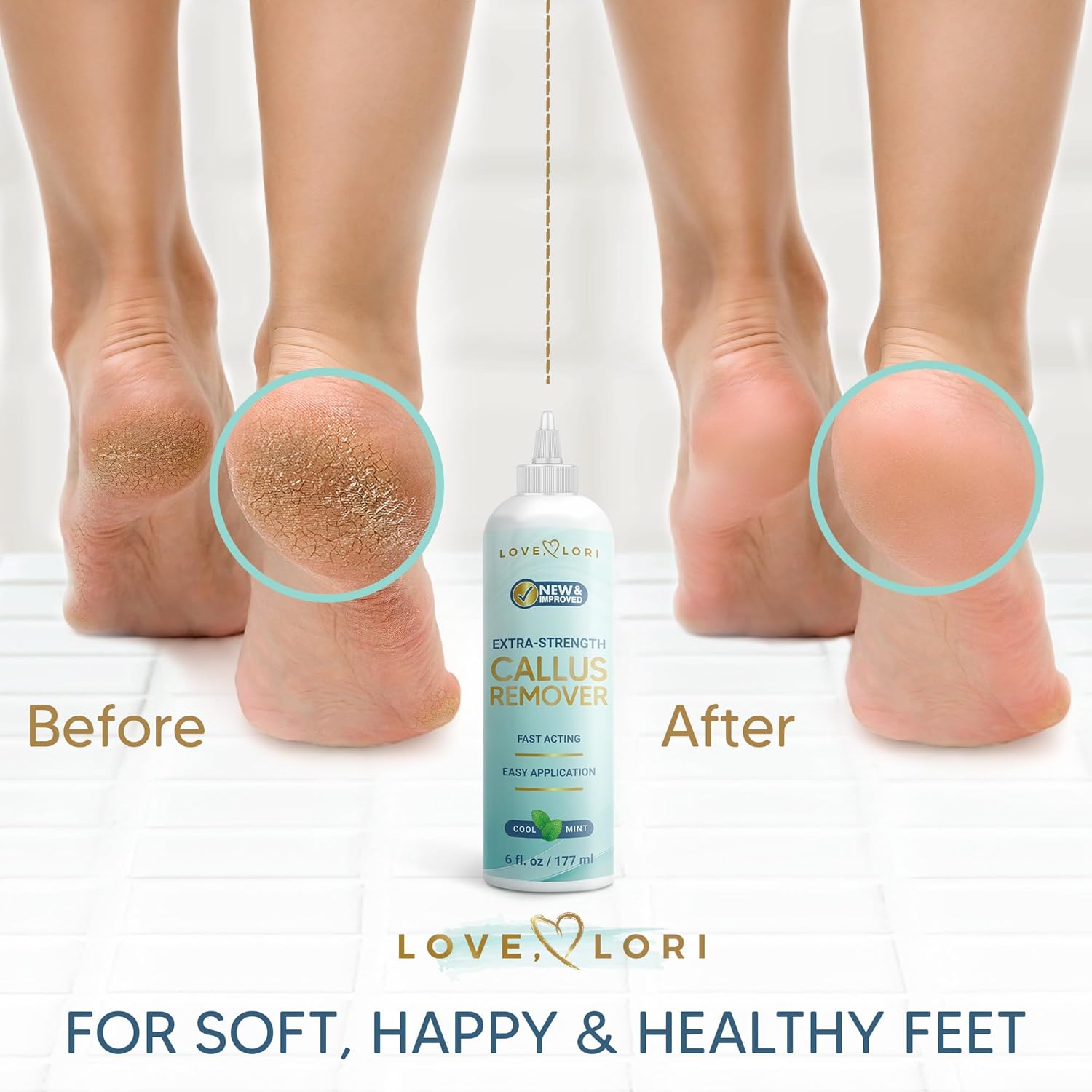 Love Lori Extra Strength Callus Remover Gel  6 oz