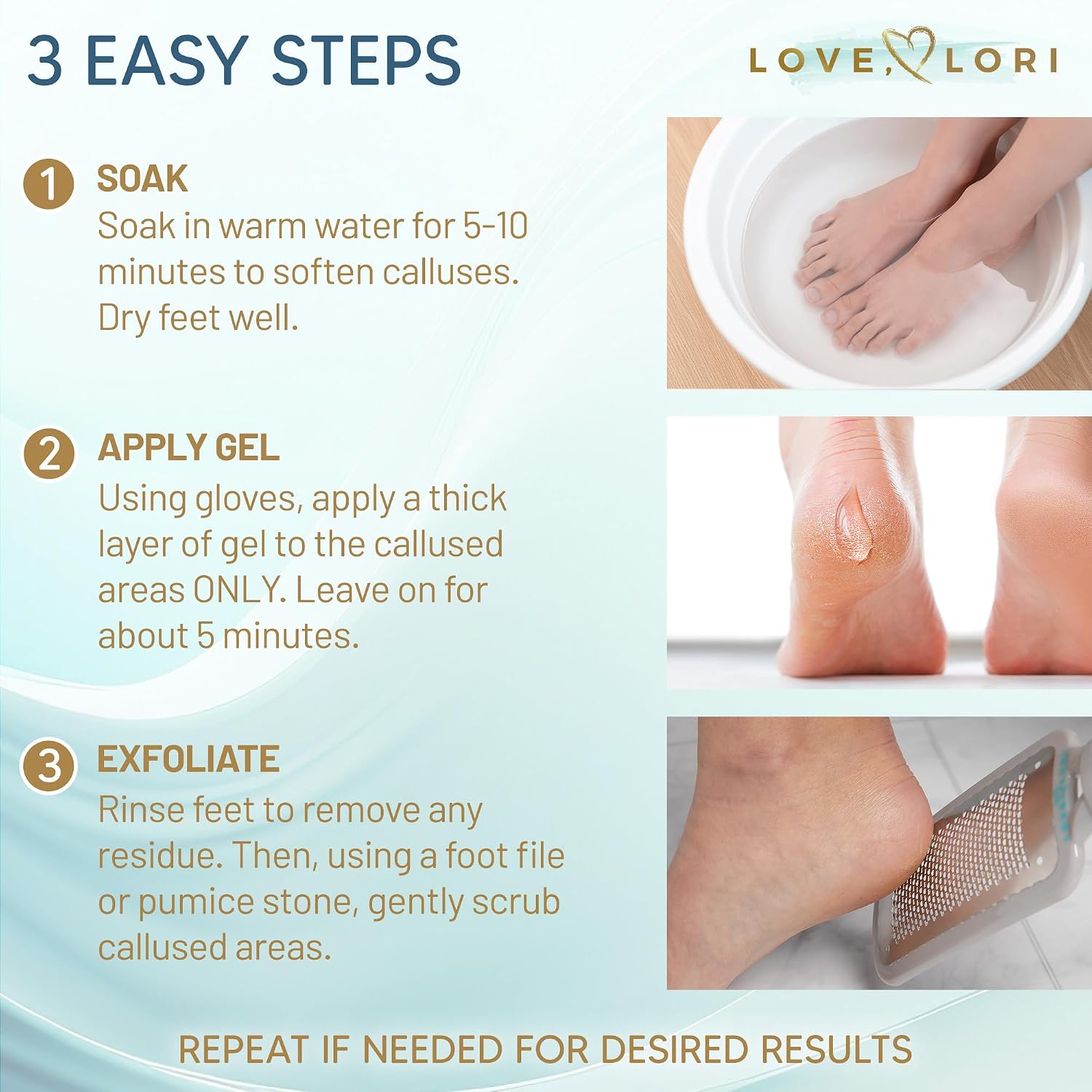 Love Lori Extra Strength Callus Remover Gel  6 oz